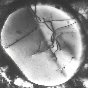 TEM_micrograph_dislocations_precipitate_stainless_steel_2